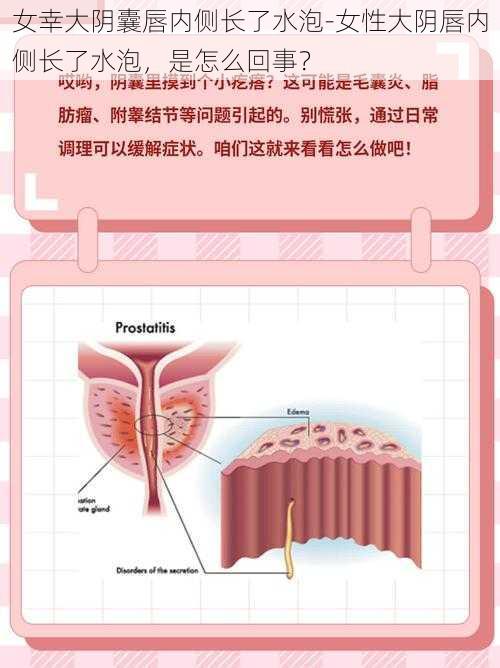 女幸大阴囊唇内侧长了水泡-女性大阴唇内侧长了水泡，是怎么回事？