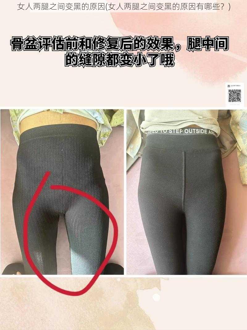 女人两腿之间变黑的原因(女人两腿之间变黑的原因有哪些？)